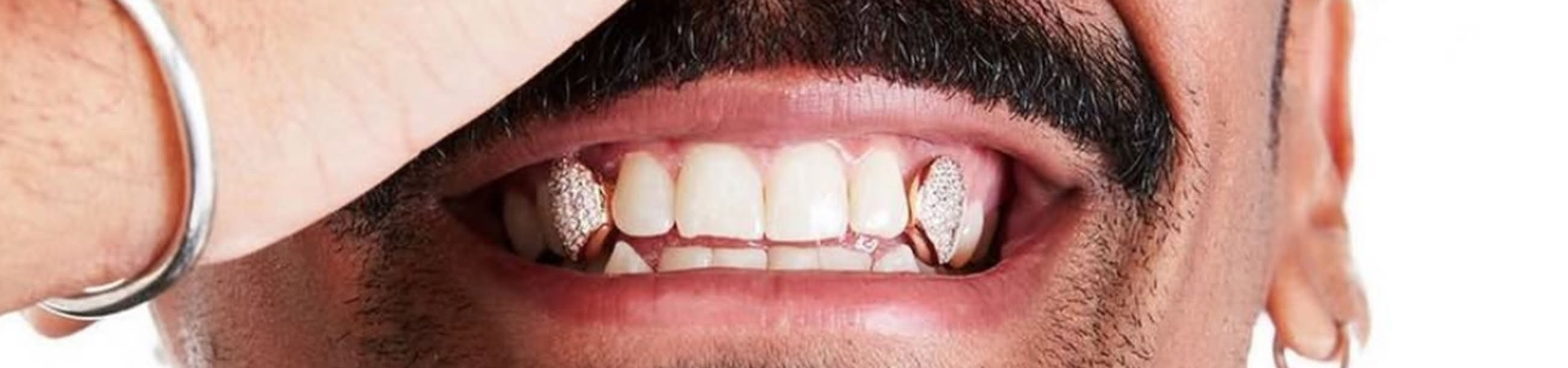 Matching gold pavé diamond fang caps on upper canine teeth, shown in a wide smile with a bracelet-adorned hand