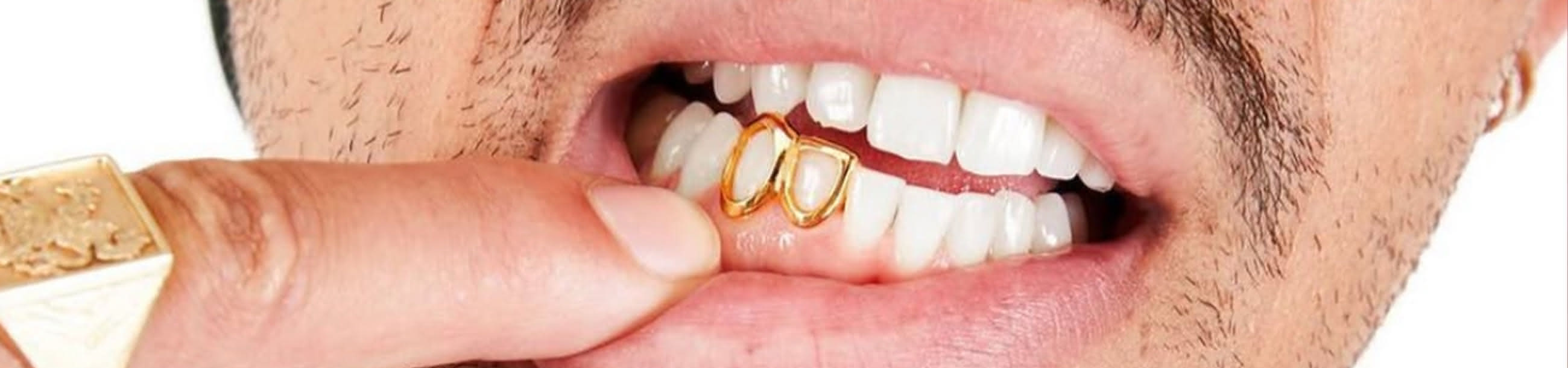 Two gold open-face bottom grillz caps on the lower front teeth, finger holding lip aside for a clear view
