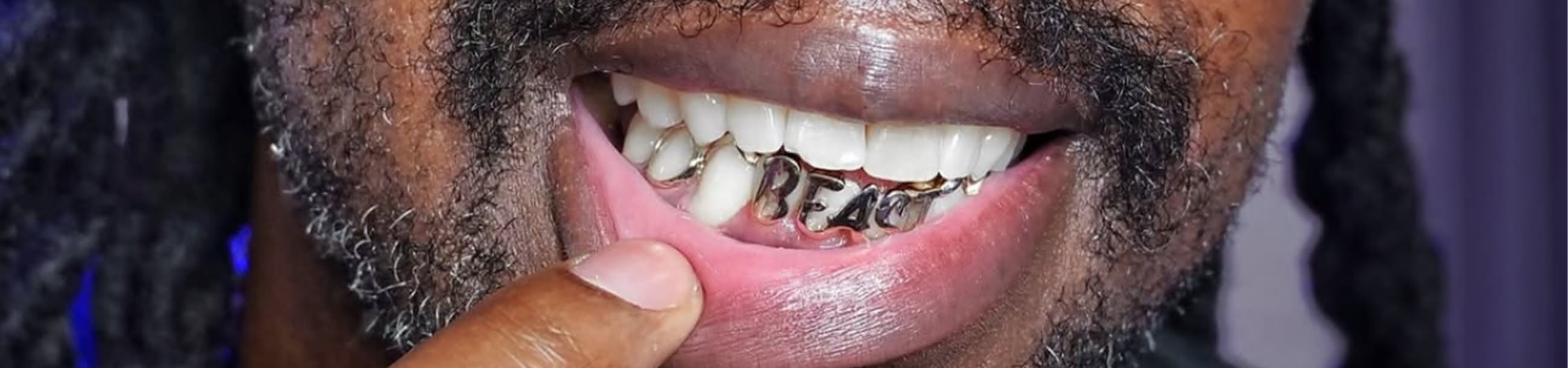 Silver bottom grillz with "BEAST" engraved in gothic lettering, pulled forward to show the custom cut