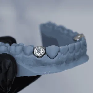 Custom white gold single-tooth crown with a bezel-set round brilliant diamond, fitted on the lower premolar position of a dental arch model