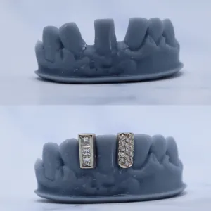 Custom diamond gap filler grillz on a dental cast, shown before and after — one cap set with three princess-cut diamonds, one with round pavé diamonds