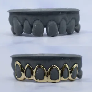 Custom yellow gold open-face bottom 8-tooth grillz on a dental cast, shown before and after — open fronts reveal natural tooth color