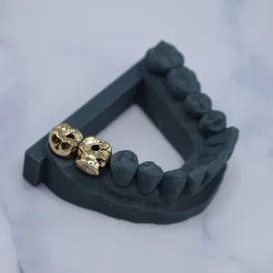 Two custom yellow gold skull-shaped implant crowns placed on the lower front teeth of a full dental arch model, one with a bezel-set round diamond accent