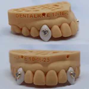 Custom porcelain vampire canine crowns with gold heart-shaped diamond accents, shown on a dental model from two angles
