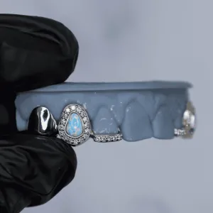 Custom white gold fang-style top grillz: a pear-shaped opal center cap with pavé diamond halo, an open-face solid side cap, and a floating diamond-tip fang cap, shown on a dental cast